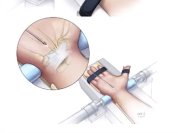 Image for hand biomechanics study at the Hand Research Laboratory