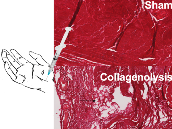 Image for collagenolysis study at the Hand Research Laboratory