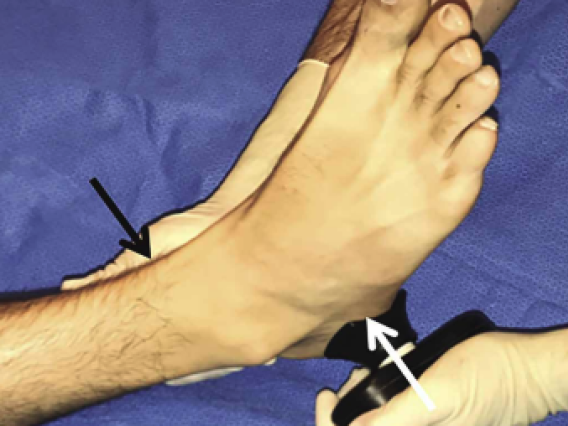 A foot being compressed for research on injury healing