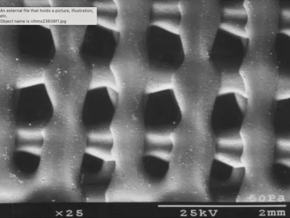 Engineered polymer bone scaffolding