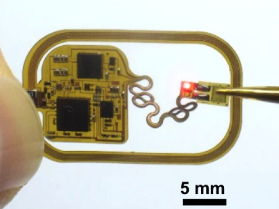 Osseosurface electronics, a small, implantable chip